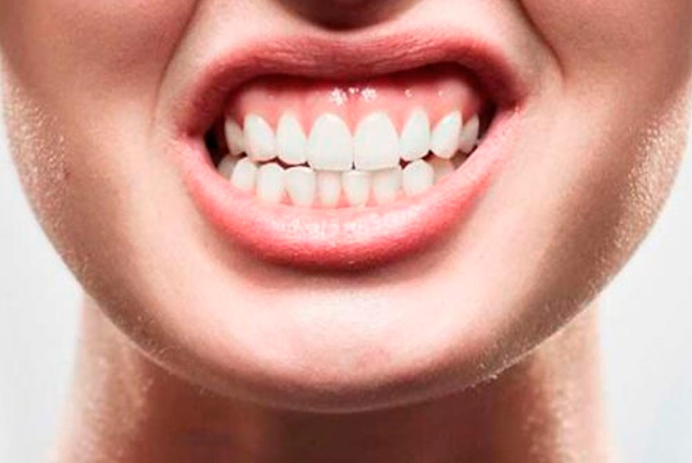 Barrancos Clínica Dental. Servicio de Bruxismo, oclusión y férulas de descarga